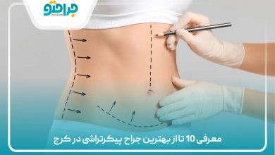 معرفی 10 تا از بهترین جراح پیکرتراشی در کرج