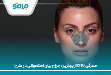معرفی 10 تا از بهترین جراح بینی استخوانی در کرج