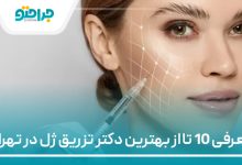 معرفی 10 تا از بهترین دکتر تزریق ژل در تهران