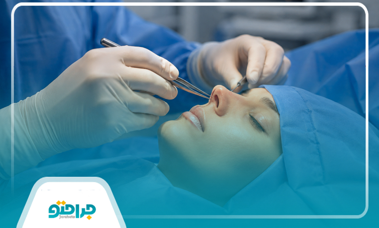 اقدامات ضروری قبل از جراحی بینی گوشتی