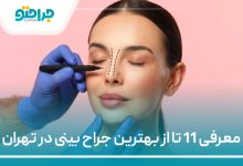 معرفی 11 تا از بهترین جراح بینی در تهران