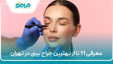 معرفی 11 تا از بهترین جراح بینی در تهران