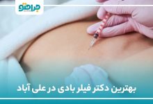 بهترین دکتر فیلربادی در علی اباد