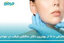 بهترین دکتر ساکشن غبغب در جوادیه