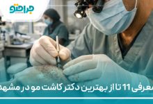 معرفی 11 تا از بهترین دکتر کاشت مو در مشهد