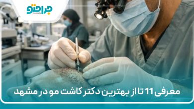 معرفی 11 تا از بهترین دکتر کاشت مو در مشهد