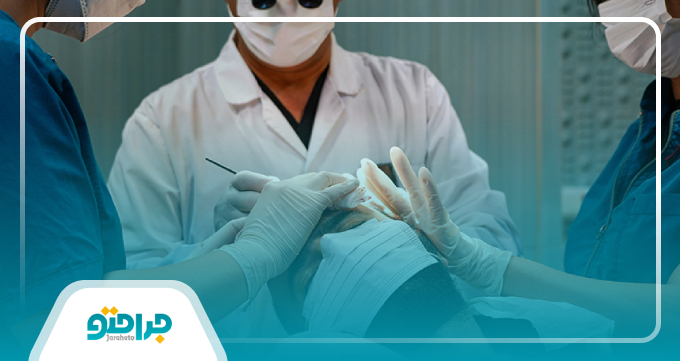 چگونه بهترین دکتر متخصص کاشت مو را انتخاب کنیم؟