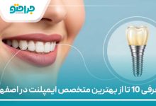 معرفی 10 تا از بهترین متخصص ایمپلنت در اصفهان