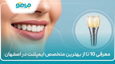 معرفی 10 تا از بهترین متخصص ایمپلنت در اصفهان