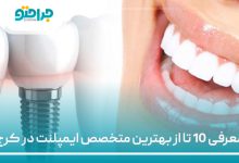 معرفی 10 تا از بهترین متخصص ایمپلنت در کرج