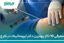 معرفی 10 تا از بهترین دکتر لیپوماتیک در کرج