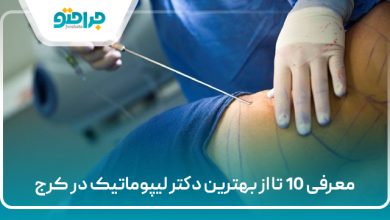 معرفی 10 تا از بهترین دکتر لیپوماتیک در کرج