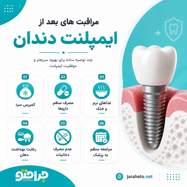 راهنمای انتخاب بهترین دکتر ایمپلنت در زنجان