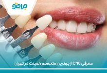 معرفی 10 تا از بهترین متخصص لمینت در تهران