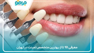 معرفی 10 تا از بهترین متخصص لمینت در تهران