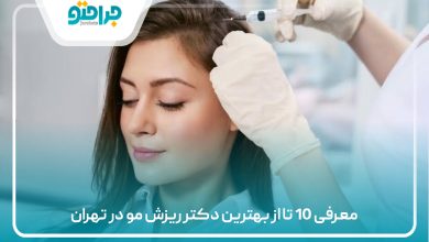 معرفی 10 تا از بهترین دکتر ریزش مو در تهران