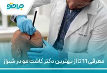 معرفی 11 تا از بهترین دکتر کاشت مو در شیراز
