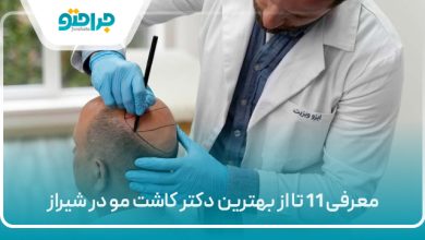 معرفی 11 تا از بهترین دکتر کاشت مو در شیراز