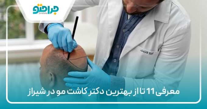 معرفی 11 تا از بهترین دکتر کاشت مو در شیراز