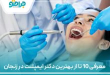 معرفی 10 تا از بهترین دکتر ایمپلنت در زنجان