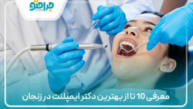 معرفی 10 تا از بهترین دکتر ایمپلنت در زنجان
