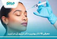 معرفی 10 تا از بهترین دکتر تزریق ژل در تبریز