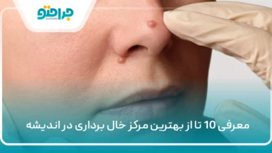 معرفی 10 تا از بهترین مرکز خال برداری در اندیشه ✅【سال1405】
