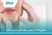 معرفی 10 تا از بهترین مرکز خال برداری در ملارد