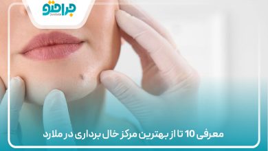 معرفی 10 تا از بهترین مرکز خال برداری در ملارد