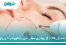 10 تا از بهترین مرکز خال برداری در شهریار ⚡【سال1405】