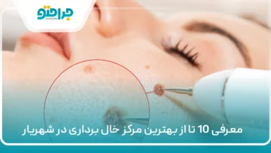 10 تا از بهترین مرکز خال برداری در شهریار ⚡【سال1405】