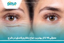 معرفی 10 تا از بهترین جراح بلفاروپلاستی در کرج