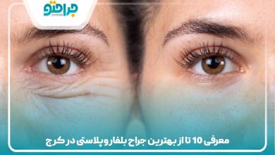 معرفی 10 تا از بهترین جراح بلفاروپلاستی در کرج