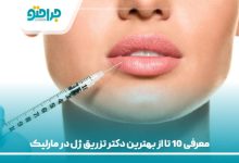 معرفی 10 تا از بهترین دکتر تزریق ژل در مارلیک