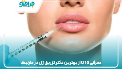 معرفی 10 تا از بهترین دکتر تزریق ژل در مارلیک