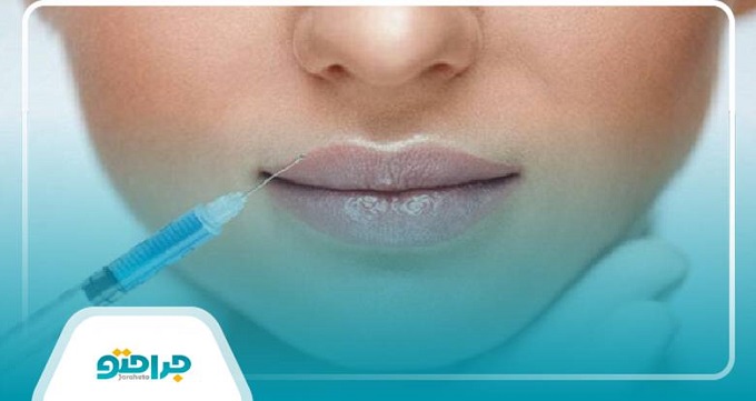 مراقبتهای قبل و بعد از تزریق ژل