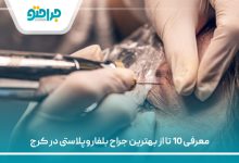 معرفی 10 تا از بهترین جراح بلفاروپلاستی در کرج