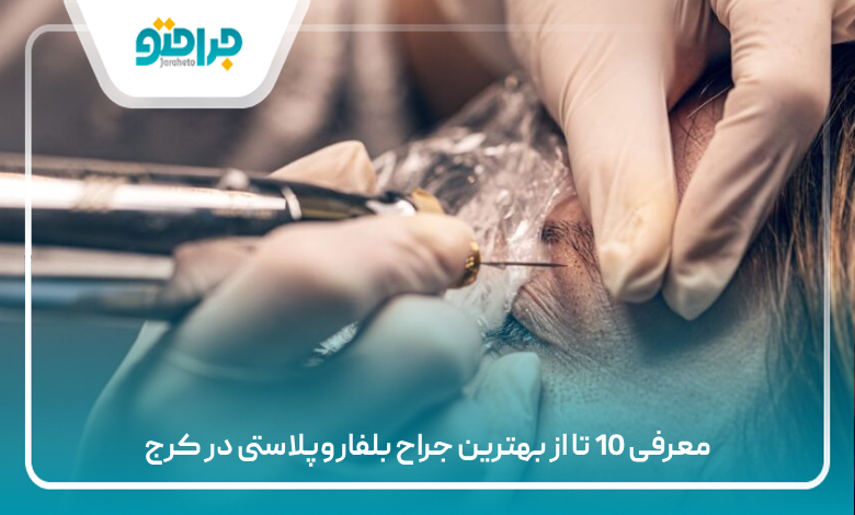 معرفی 10 تا از بهترین جراح بلفاروپلاستی در کرج
