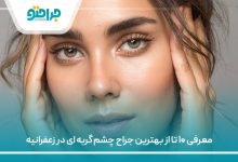 معرفی ۱۰ تا از بهترین جراح چشم گربه ای در زعفرانیه
