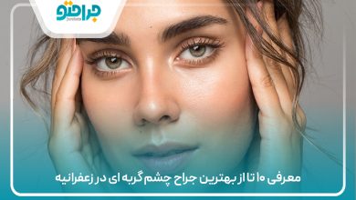 معرفی ۱۰ تا از بهترین جراح چشم گربه ای در زعفرانیه
