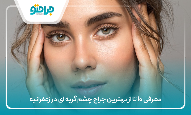 معرفی ۱۰ تا از بهترین جراح چشم گربه ای در زعفرانیه