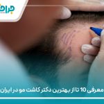 معرفی 10 تا از بهترین دکتر کاشت مو در ایران【سال1405】❤️