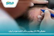 معرفی 10 تا از بهترین دکتر کاشت مو در ایران