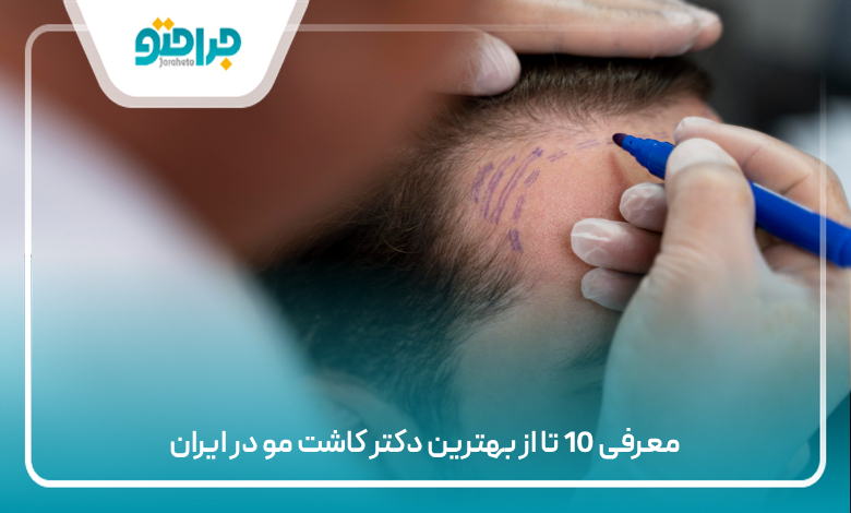 معرفی 10 تا از بهترین دکتر کاشت مو در ایران