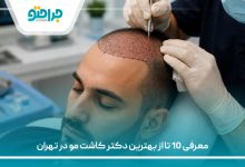 معرفی 10 تا از بهترین دکتر کاشت مو در تهران