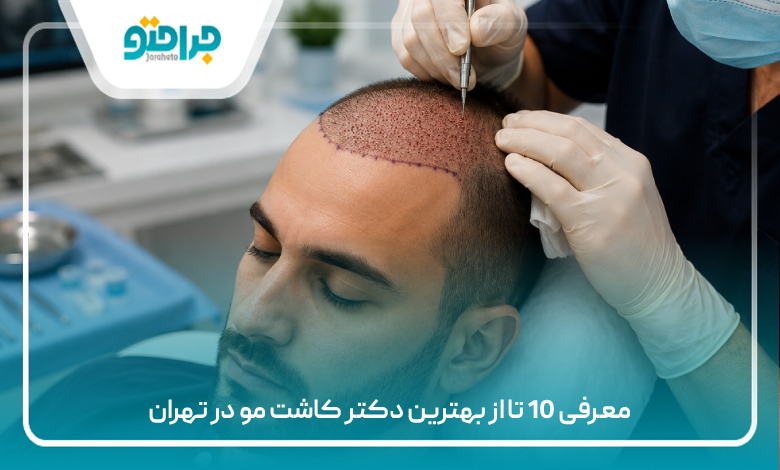 معرفی 10 تا از بهترین دکتر کاشت مو در تهران