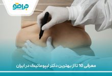 معرفی 10 تا از بهترین دکتر لیپوماتیک در ایران