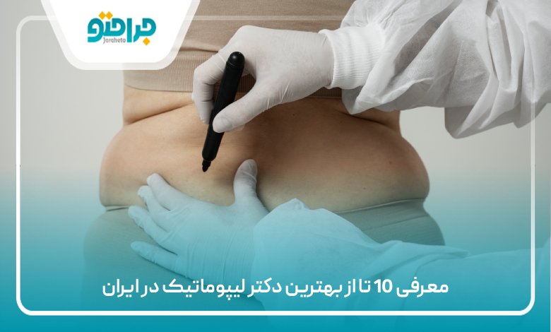 معرفی 10 تا از بهترین دکتر لیپوماتیک در ایران