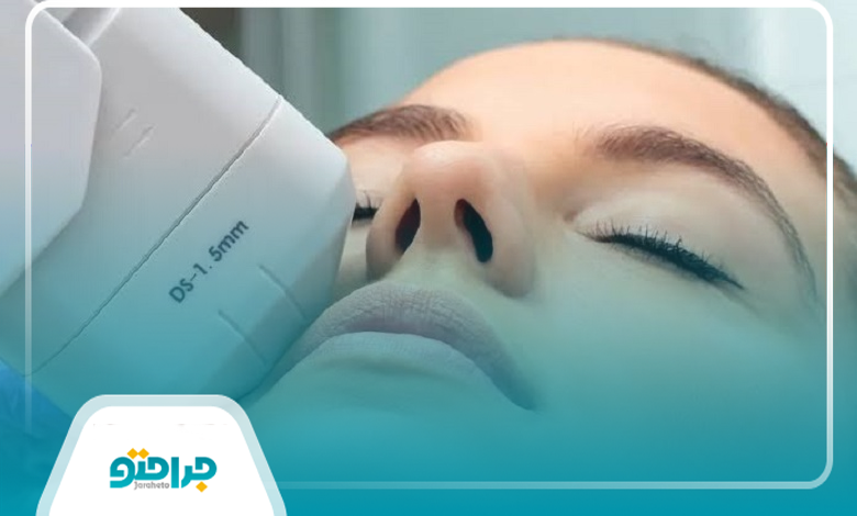 مدتزمان هایفوتراپی و تعداد جلسات موردنیاز