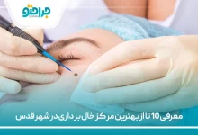 معرفی 10 تا از بهترین مرکز خال برداری در شهر قدس